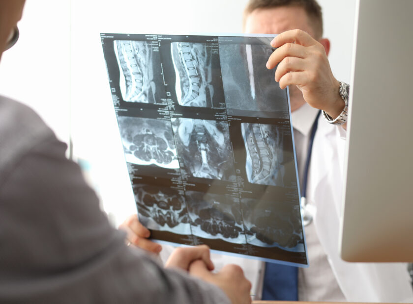 Doctor hold xray bone spine radiography in hand