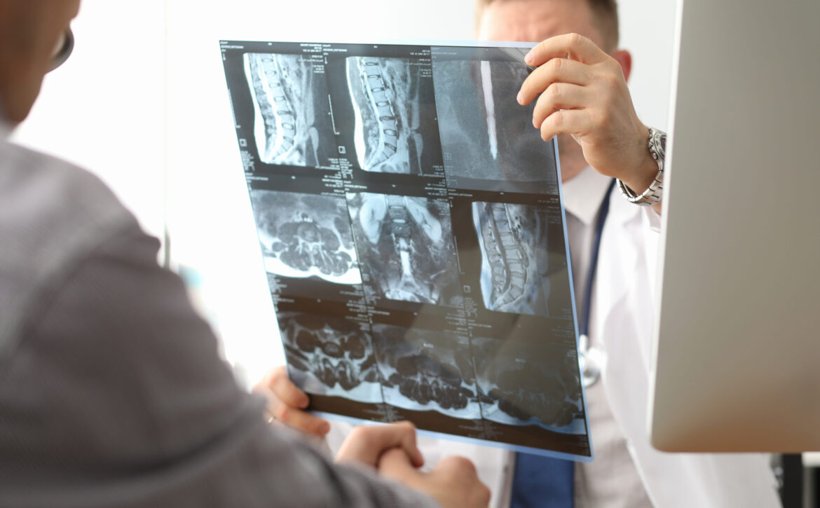 Doctor hold xray bone spine radiography in hand