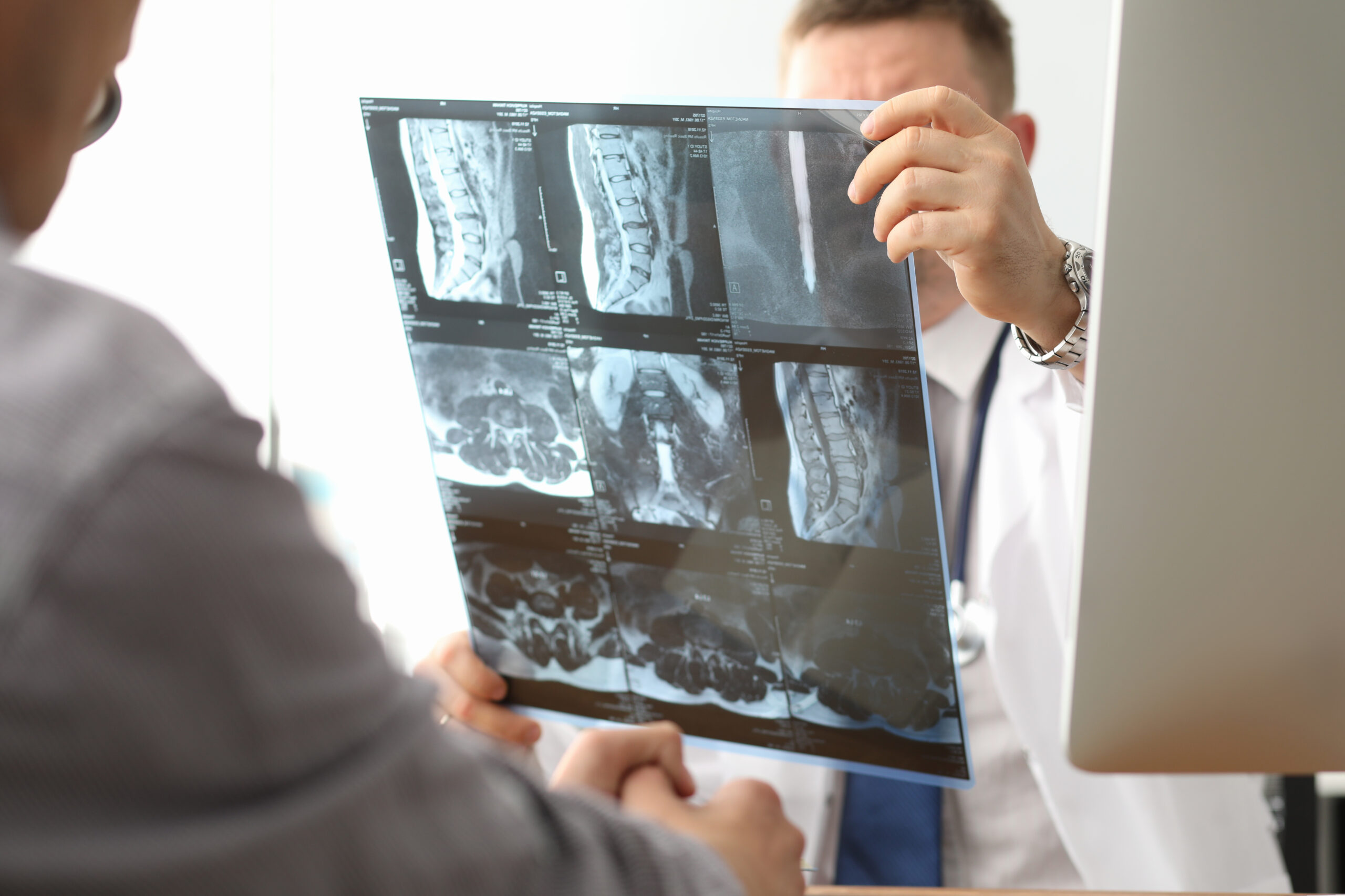Doctor hold xray bone spine radiography in hand